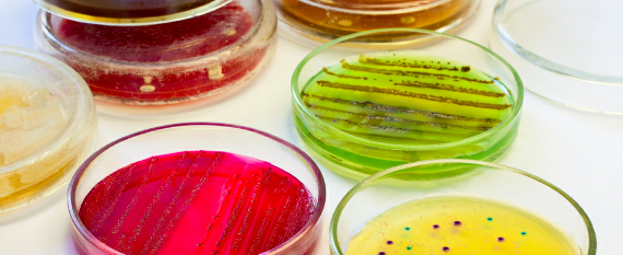 Снизьте риск контаминации в Вашей лаборатории клеточных культур